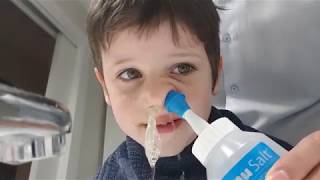 Cómo limpiar la sinusitis a un niño [upl. by Kallman]