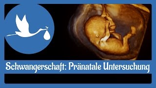 Schwangerschaft Pränatale Untersuchung [upl. by Issak]