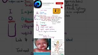 Mnemonics for Microbiology Staphylococcus Aureus shorts short microbiology [upl. by Heman]