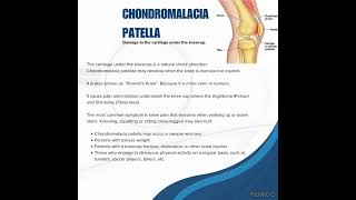 Chondromalacia Patella KNOWLEDGE AROUND  WELCOME TO KNOWLEDGE AROUND I knowlegdearound [upl. by Elinore]