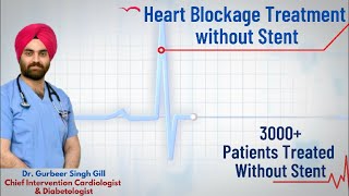 Heart Blockage Treatment without Stent  Oxford Hospital Jalandhar  Dr Gurbeer Singh Gill [upl. by Weatherley]