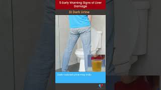 5 Early Warning Signs of Liver Damage  Med About You [upl. by Anilak860]