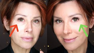 Before You Conceal Under Eye Bags amp Circles WATCH THIS  Dominique Sachse [upl. by Rie]