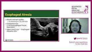 Fetal Abdomen and Anterior Abdominal Wall  Dr Sheryl Choo  Advanced fetal Imaging Conference [upl. by Ermey421]