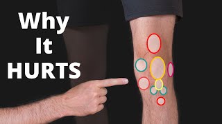 Why Your Knee Hurts Knee Pain Types by Location Chart  Symptoms [upl. by Enelehcim1]