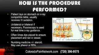 Lumbar Sympathetic Block Overview from a Denver Pain Management Clinic [upl. by Thill]