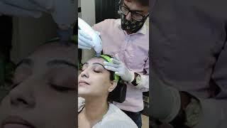 DermaSuction  Pore Cleaning [upl. by Santa]