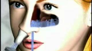 Nasaline Nasal Irrigator [upl. by Nolyar675]