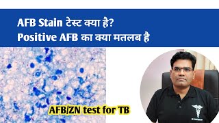 AFB Stain test kya hai  एएफ़बी टेस्ट पॉज़िटिव का क्या मतलब है   TB ki Janch [upl. by Yttik]