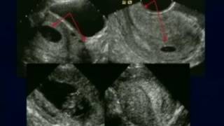 The Standard Antepartum Obstetrical Sonogram AIUM Guidelines Revisited [upl. by Oiluj]