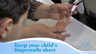 Eczema Tips to help your child feel better [upl. by Tnelc]