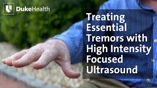 Outpatient Procedure Relieves Essential Tremor  Duke Health [upl. by Rohn]