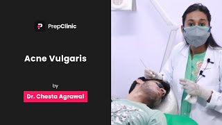 Acne Vulgaris  Dr Chesta Agrawal  Dermatology PrepClinic [upl. by Ettezoj901]