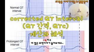 corrected QT intervalQT 간격 QTc 계산과 해석 [upl. by Guinevere]