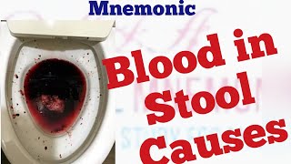 Causes of blood in stool Mnemonic [upl. by Omsare]