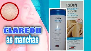 TESTEI O UREADIN NA QUERATOSE PILARFUNCIONOU resenha ISDIN UREADIN loção 10 ureia corporal [upl. by Onia]