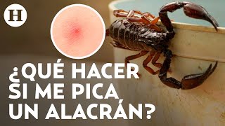 ¡Temporada de alacranes en México Esto debes hacer en caso de ser picado por uno de estos animales [upl. by Aluin]