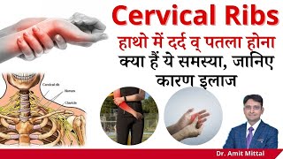 सर्वाइकल रिब्स हाथ में दर्द और हाथ का पतला होना क्या हैं Cervical Ribs लक्षण कारण उपचार [upl. by Nhar]