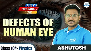 Defects of Human Eye  Class 10 Physics  Class10Preparation  LIVE  InfinityLearn910 [upl. by Lauren]