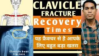 Clavicle bone fracture treatment collar bone fracture recovery time in hindi haddi kaise judti hi [upl. by Tilford]