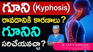 What is Kyphosis Can Kyphosis be corrected  I Kyphosis I scoliosis treatment I Dr GPV Subbaiah [upl. by Divadnhoj632]