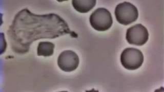 Neutrophil chasing a bacteria [upl. by Malley]