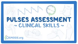 Clinical Skills Pulses assessment [upl. by Rice]