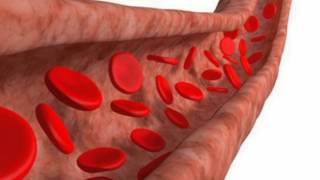 Difference Between Arteriosclerosis and Atherosclerosis [upl. by Ezri352]