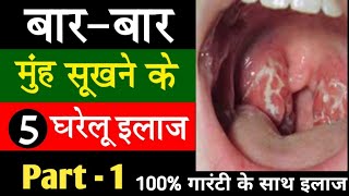 Part  1 Muh sukhna aur ghabrahat hona  Muh sukhne ka ilaj  Dry mouth causes remedies treatment [upl. by Elsey]