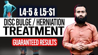 Get Rid Of L4 L5 And L5 S1 Disc Bulge With This Home Treatment  Guaranteed Results [upl. by Eugenle]