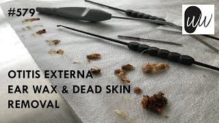 Ear Wax Removal Kit How to [upl. by Ynitsed204]