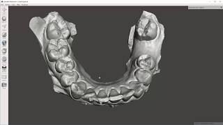 Video 1 of 5 MeshMixer  Dental Model Cleanup [upl. by Gualterio]