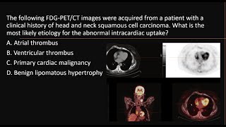 Cardiovascular uptake using PET in oncological patients MCQs nuclearmedicineMCQ petct frcr [upl. by Thormora]