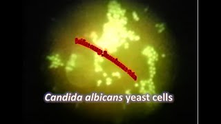 Candida albicans under Fluorescence microscope stained with Acridine Orange [upl. by Oicor]