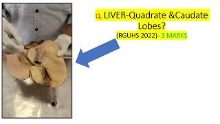 LIVER CAUDATE AND QUADRATE LOBE [upl. by Aroz]