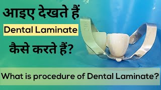 Dental Laminate l आइए देखते हैं Dental Laminate कैसे करते हैं [upl. by Hildebrandt]