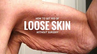 How to TIGHTEN EXTRA LOOSE SAGGY SKIN Without Surgery After Weight Loss  Remedies GUARANTEED ✓ [upl. by Arrim]