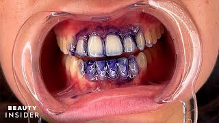 Purple Teeth Stains Can Temporarily Brighten Yellow Stains  Beauty Insider [upl. by Barbey]