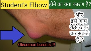 Olecranon Bursitis Elbow Bursitis  Students Elbow  Prevention Treatment Exercises amp Home Care [upl. by Arreyt]