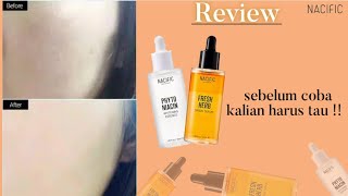 REVIEW NACIFIC  Fresh herb serum amp Phyto Niacin Essens kulit keringpori2 besar wajib coba [upl. by Retsev69]