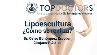 Lipoescultura ¿Cómo se realiza [upl. by Annekcm]