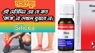 Silicea Homeopathic Medicine Uses amp Symptoms।Silicea 200। Silicea 12X। সাইলিসিয়া হোমিওপ্যাথি ডোজ। [upl. by Ishmul]