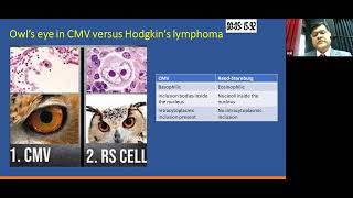 Non Hepatotropic Viruses as a Cause for Acute Viral Hepatitis Prof Amit Goel Hepatology [upl. by Ahsiemak]