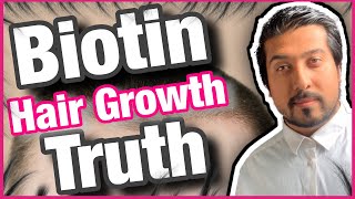 Biotin Hair Growth Truth Revealed  Is Biotin Good for Hair Growth 💇‍♂️ [upl. by Adehsar108]