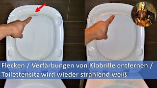 Flecken  Verfärbungen von Klobrille entfernen  Toilettensitz wird wieder strahlend weiß [upl. by Genevra]