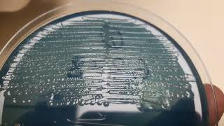 Proteus mirabilis Colony morphology on CLED agar [upl. by Keraj]