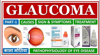 GLAUCOMA ग्‍लूकोमा या काला मोतिया क्‍या है PATHOPHYSIOLOGY CAUSES amp SYMPTOMS OPTIC NERVE DAMAGE [upl. by Deraj484]