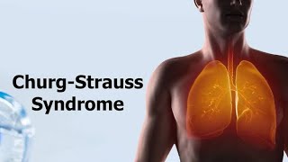 Churg Strauss Syndrome  Eosinophilic Granulomatosis With Polyangiitis Causes and treatment [upl. by Lozano]