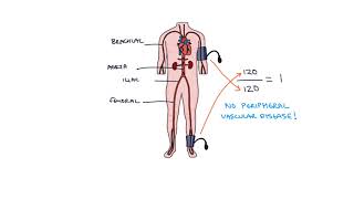 Understanding Ankle Brachial Pressure Index ABPI in Peripheral Vascular Disease [upl. by Amalee]