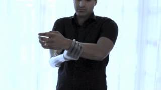 The MOST advanced bionic arm in the world [upl. by Anitsrhc]